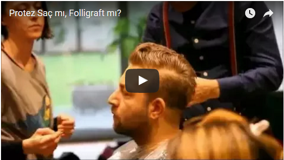 protez saç mı folligraft mı, nova hair, folligraft, micro system