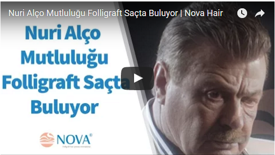 nuri alço protez saç, saç protezi, folligraft, nova hair