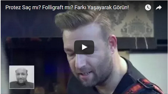protez saç mı folligraft mı, nova hair, folligraft